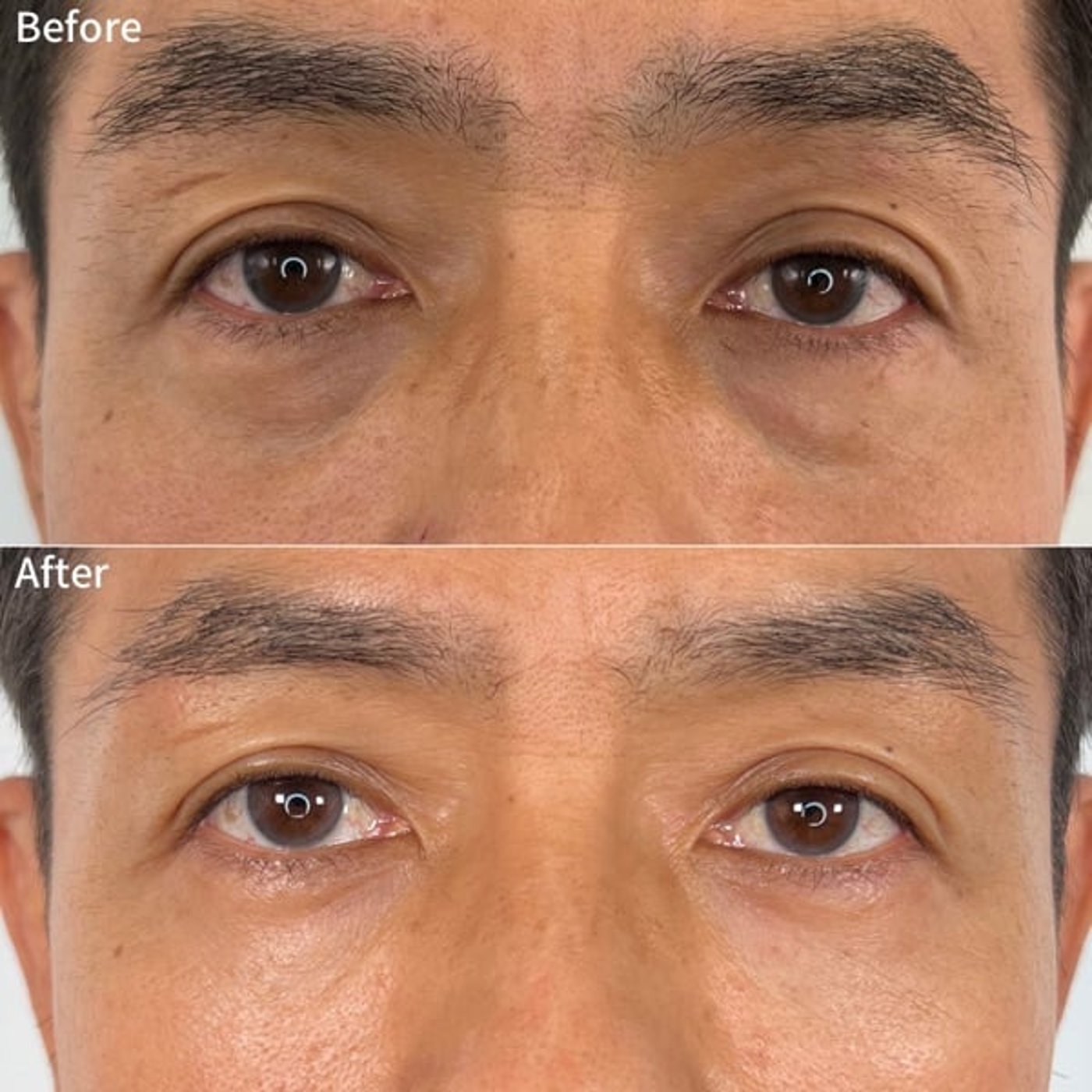 #637 クマ取りしました