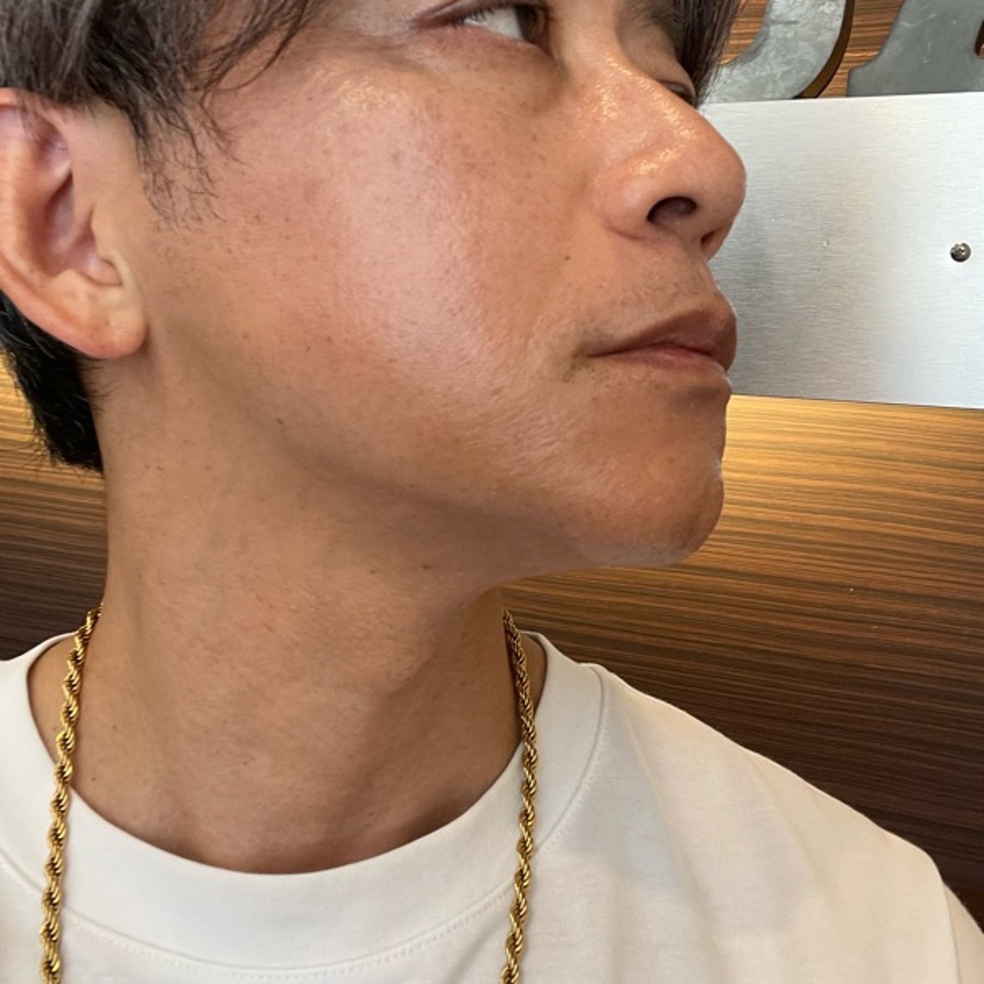 【メンズ脱毛】ひげ脱毛の結果はどうなった？