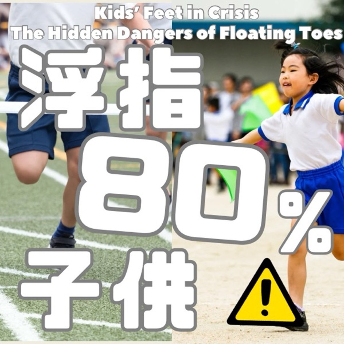 浮指の子どもが8割に！生活習慣が招く足の異変