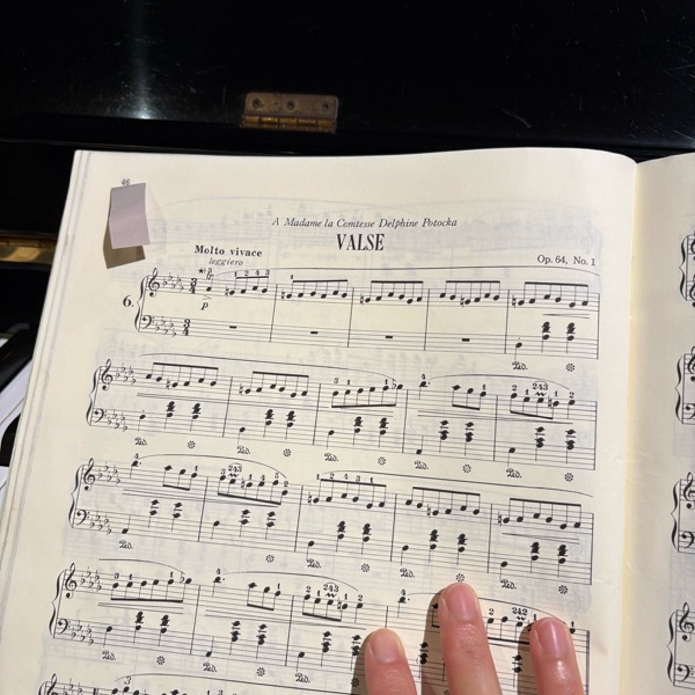 Chopin VALSE Op.64-1 (子犬のワルツ) 練習経過 episode artwork