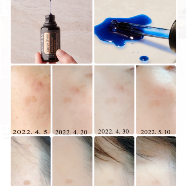 芳香療法】「シミに」ヤローポム経過報告 - 暮らしとアロマ〜お薬以外